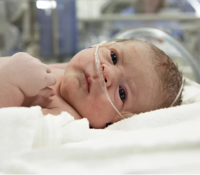 фото 2 канюля носовая неонатальная для новорожденных