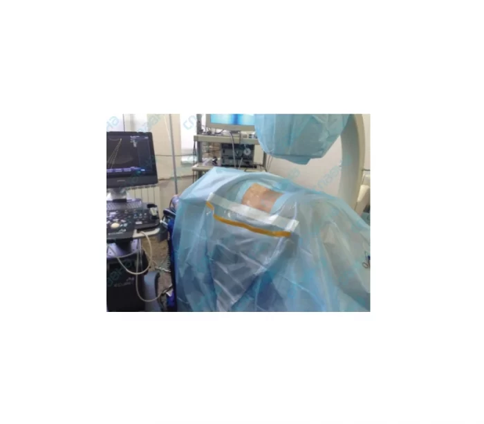 фото 3 покрытие операционное для урологии Славна №6 стерильное